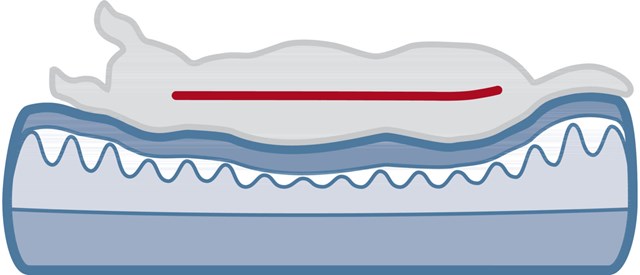 Lino Vital orthopaedic dog bed